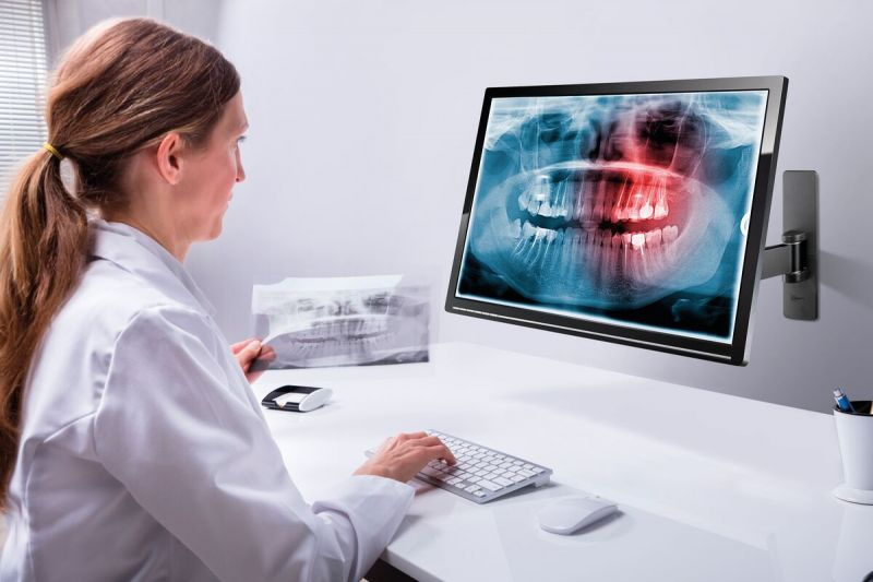 PFW 1030 - V�ggf�ste, 247mm