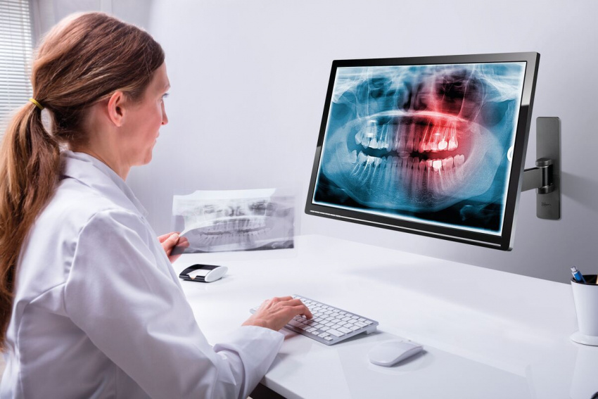 PFW 1040 - V�ggf�ste, 417mm